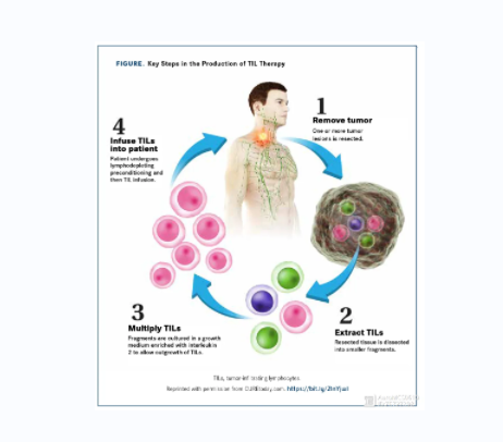 全国首例TILs细胞疗法治愈病例出现！